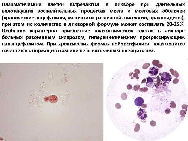 Плазматические клетки в крови у ребенка
