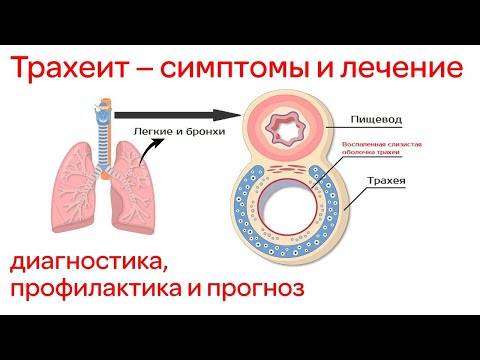 Симптомы и лечение синусита у детей, как вылечить хронический острый гнойный синусит