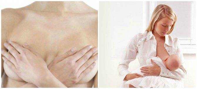 Боль грудная – причины, симптомы, диагностика и лечение