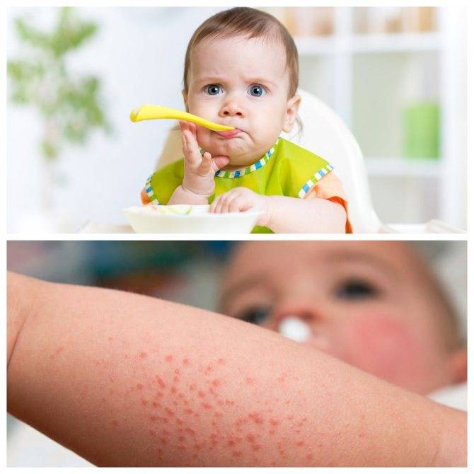 Список алергенных продуктов - пищевая аллергия у ребенка