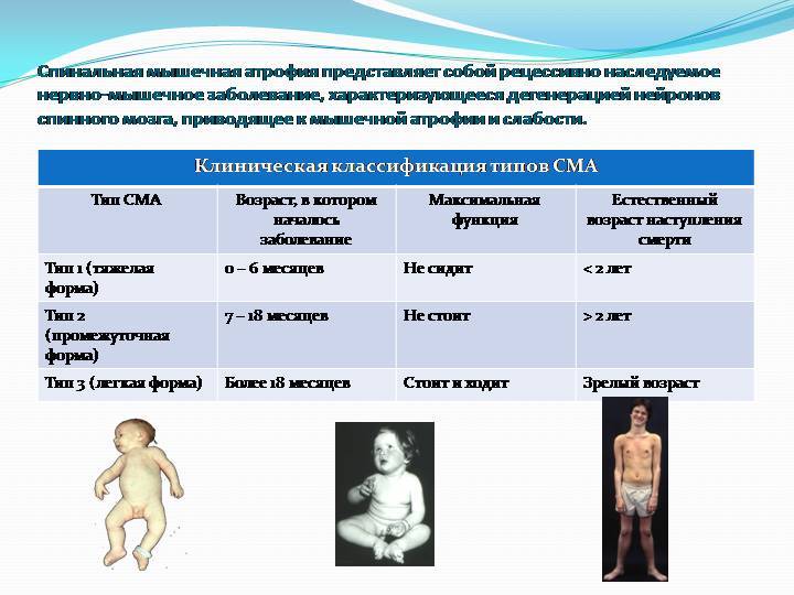 Атрофия четырехглавой мышцы бедра