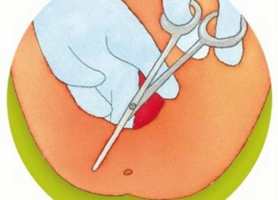 Обезболивание родов. немедикаментозные методы снятия родовой боли