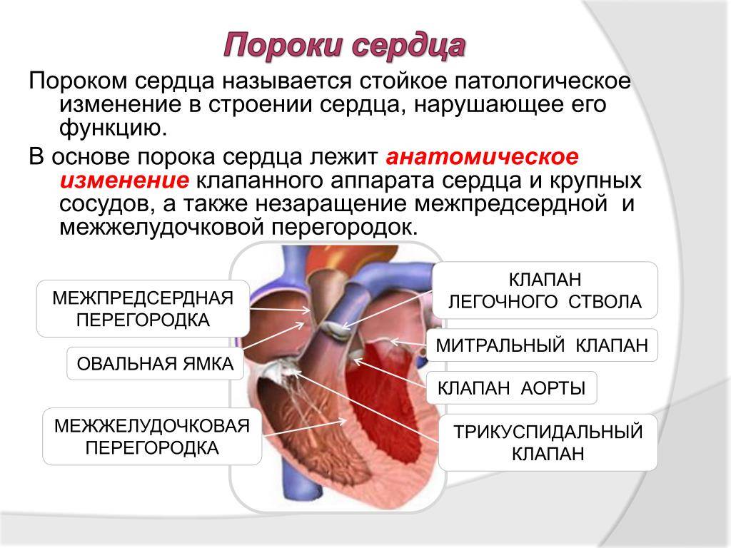 Диагностика и лечение пороков сердца у детей (сергиев посад) | парацельс