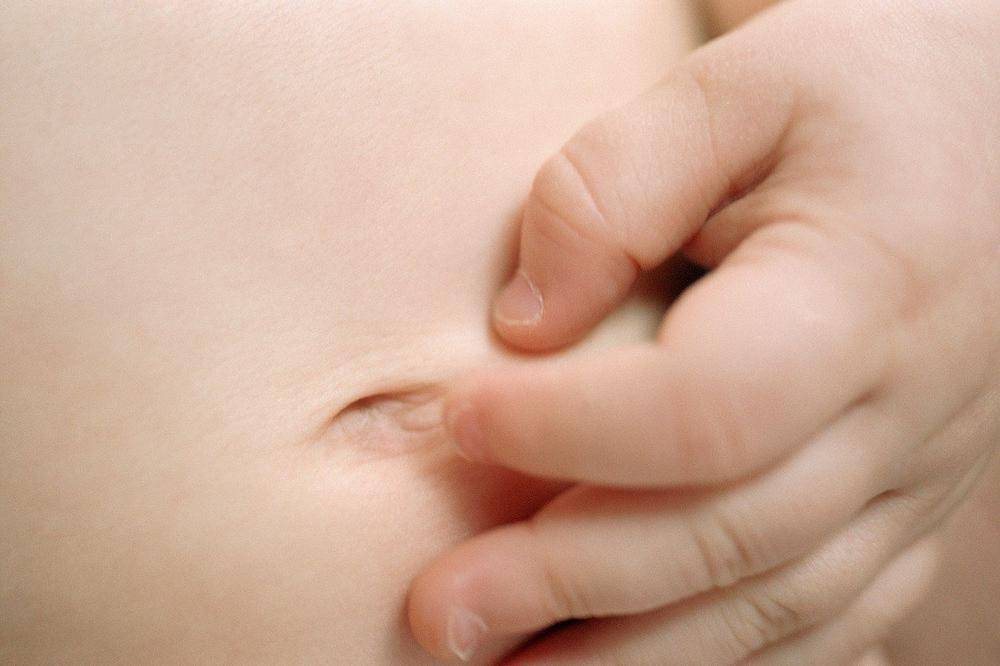 Массаж при пупочной грыже у новорожденных в домашних условиях