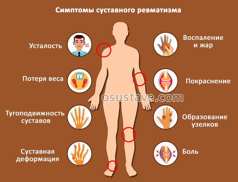 Диагностика и лечение ревматизма (александров)