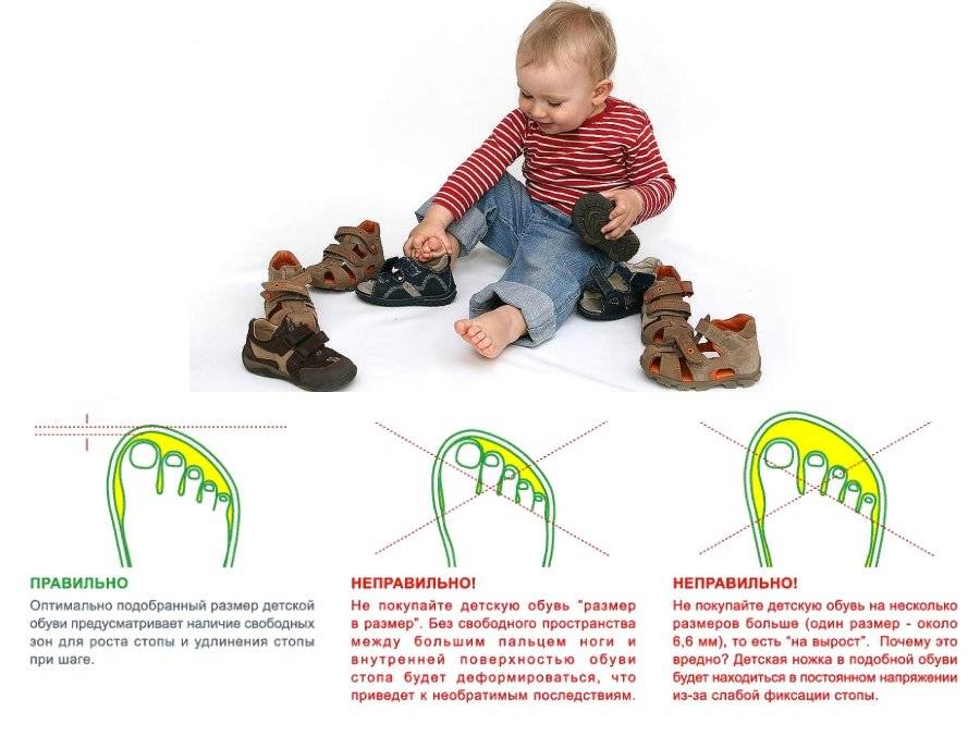 Как выбрать ортопедическую обувь ребенку? - сибирский медицинский портал