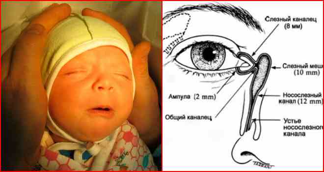 Массаж глаз при конъюнктивите у новорожденных детей