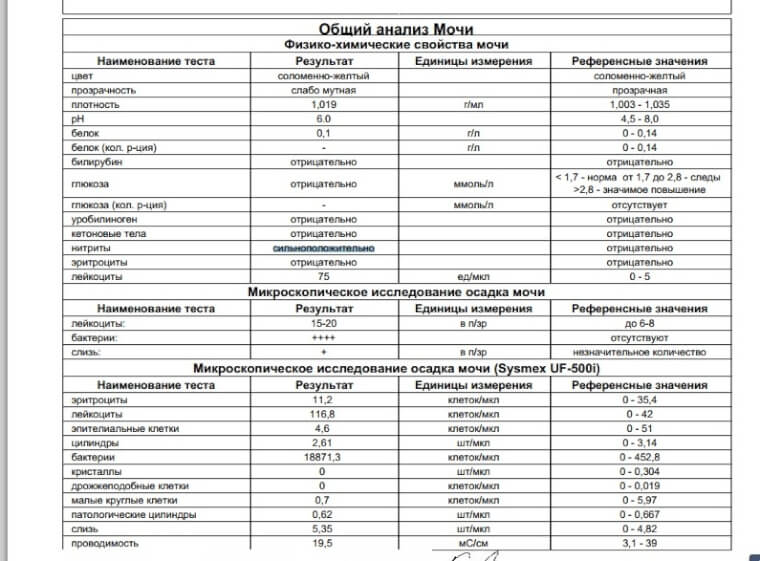 Кристаллурия в общем анализе мочи. норма и патология * клиника диана в санкт-петербурге