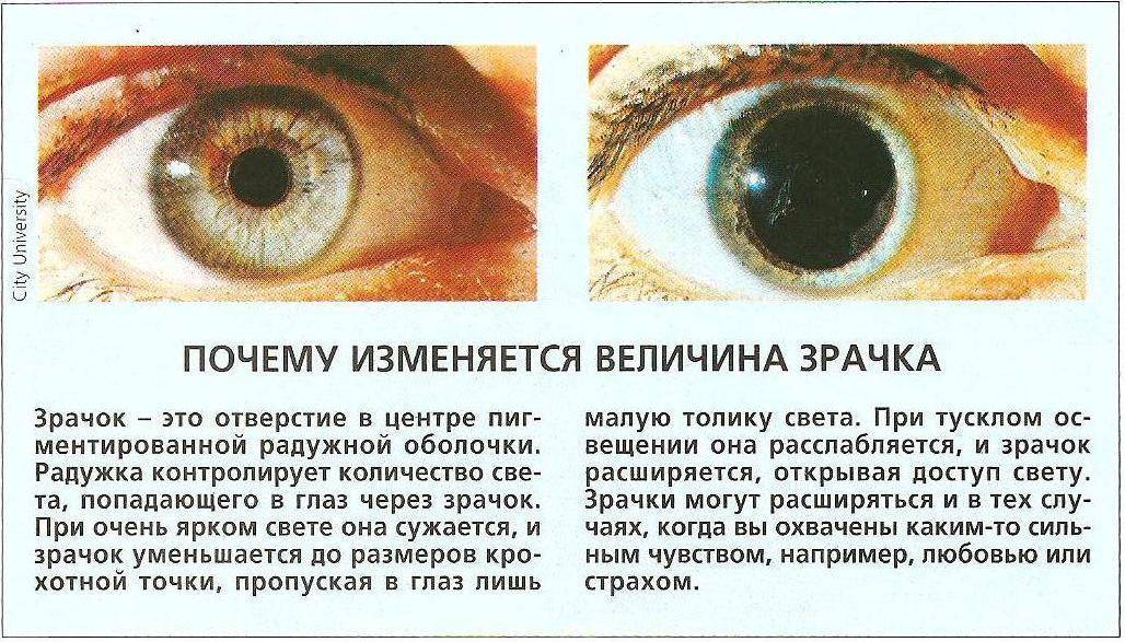 Психосоматика заболеваний глаз