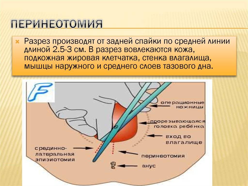 Родовая травма: что это такое, причины, симптомы и способы лечения - московский центр остеопатии
