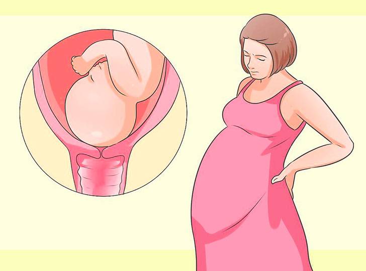 Как ускорить раскрытие шейки матки перед родами: позы, упражнения