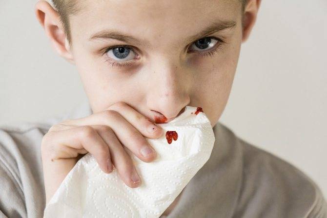 Почему у ребенка из носа идет кровь и как ее остановить?