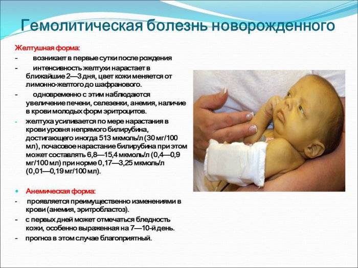 Норма билирубина у новорожденных - ответ детского врача