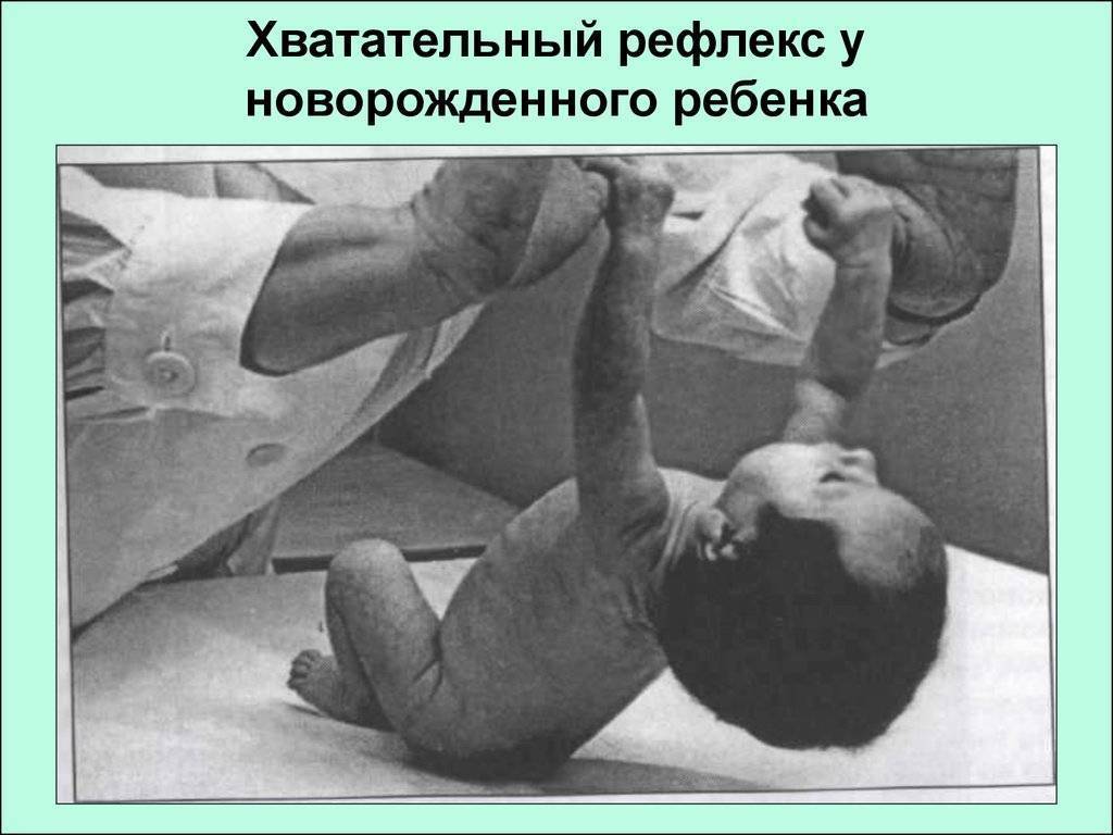 Синдром двигательных нарушений (сдн) ~ факультетские клиники иркутского государственного медицинского университета