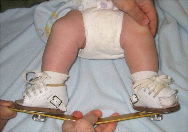 У ребенка после орви или орз болит нога