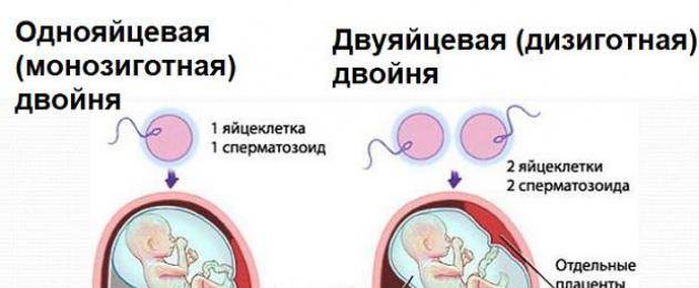 Многоплодная беременность после эко. двойня после эко: все плюсы и минусы «двойного успеха.