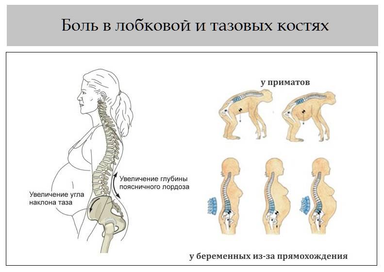 Боли во втором триместре у беременных | что делать, если болит тело во втором триместре? | лечение боли и симптомы болезни на eurolab