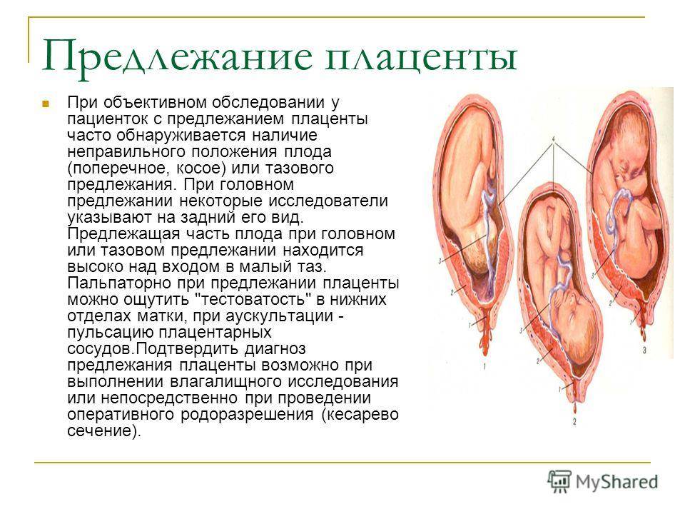 Плацента человека | анатомия плаценты, строение, функции, картинки на eurolab