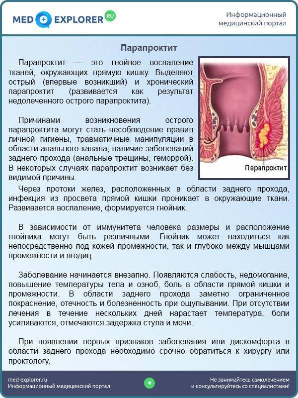 Гкб №31 - лечение геморроя при беременности | гкб №31 города москвы