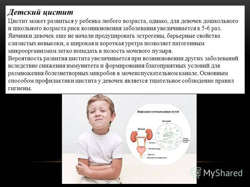 Синдром ретта у детей: общие сведения и симптомы