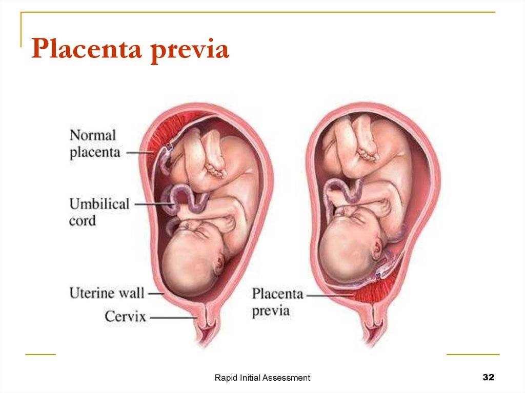Что такое плацента