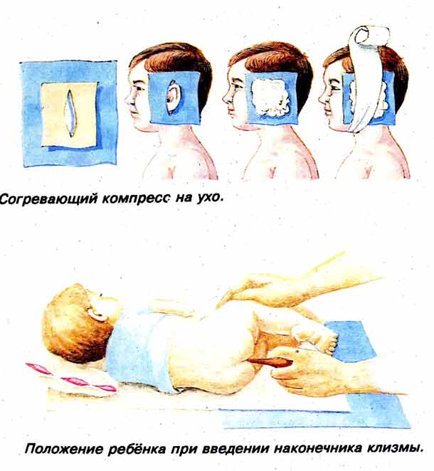 ✅ как сделать компресс на ухо. процесс прикладывания компресса - частная детская поликлиника в магнитогорске - алекус.рф