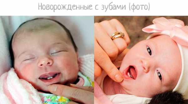 Что означает, если ребенок родился с зубами: сверхкомплектные, натальные и запасные, примета