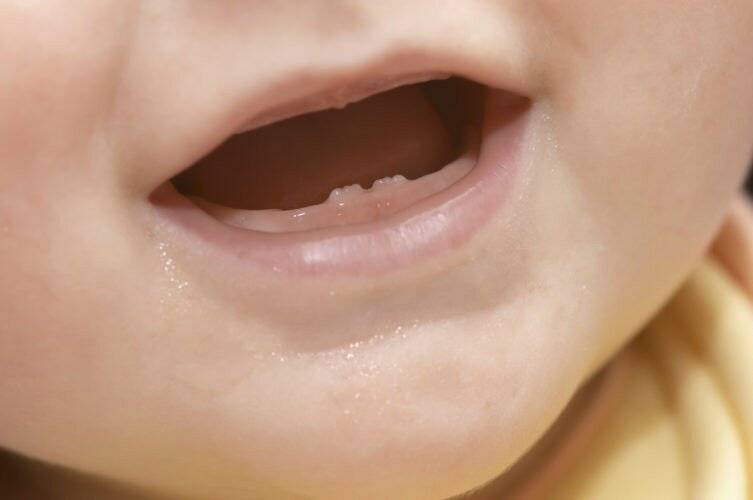Стоматит у детей: лечение и симптомы