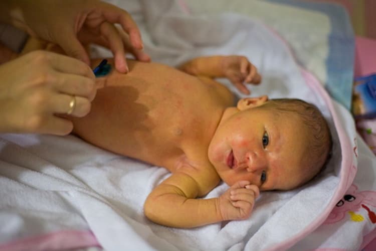 Механическая желтуха ─ одна из разновидностей желтух у новорожденных
