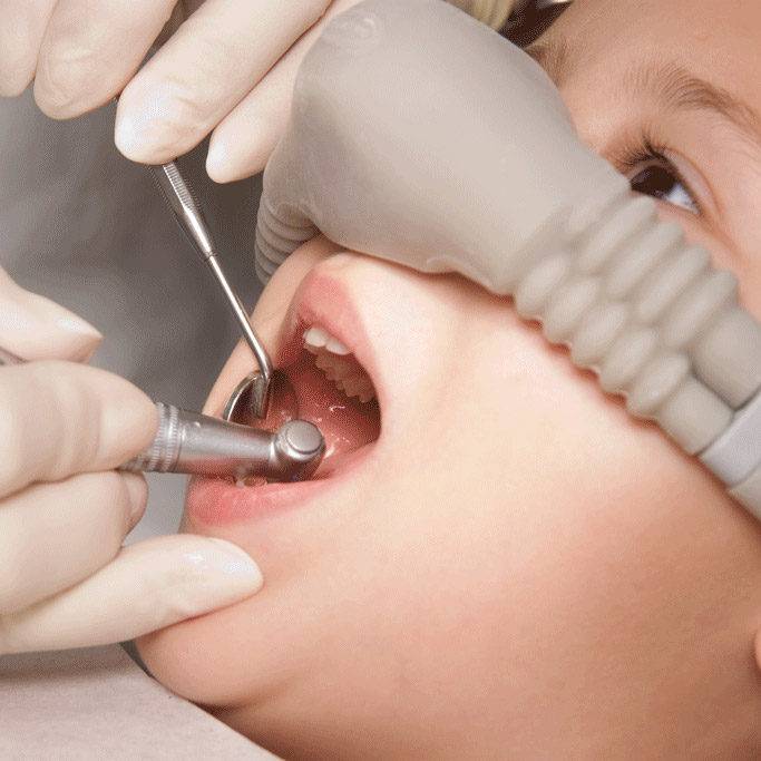 Когда применяется местная анестезия в стоматологии, а когда - седация. их плюсы и минусы.