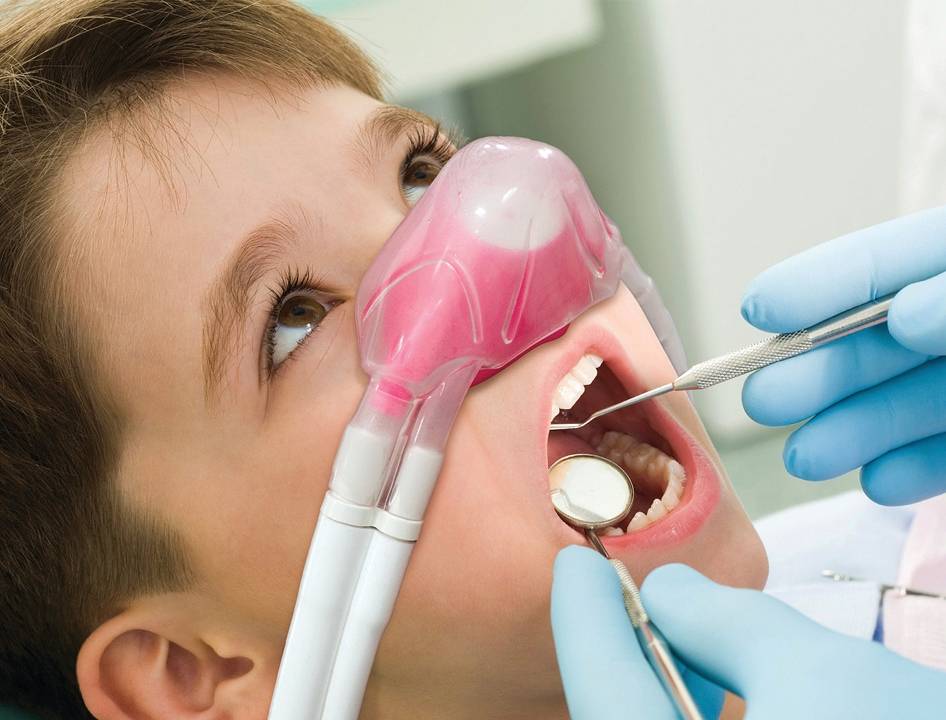 Лечение зубов под закисью азота детям в москве | медико-стоматологический центр «трилогия» на м. сокол