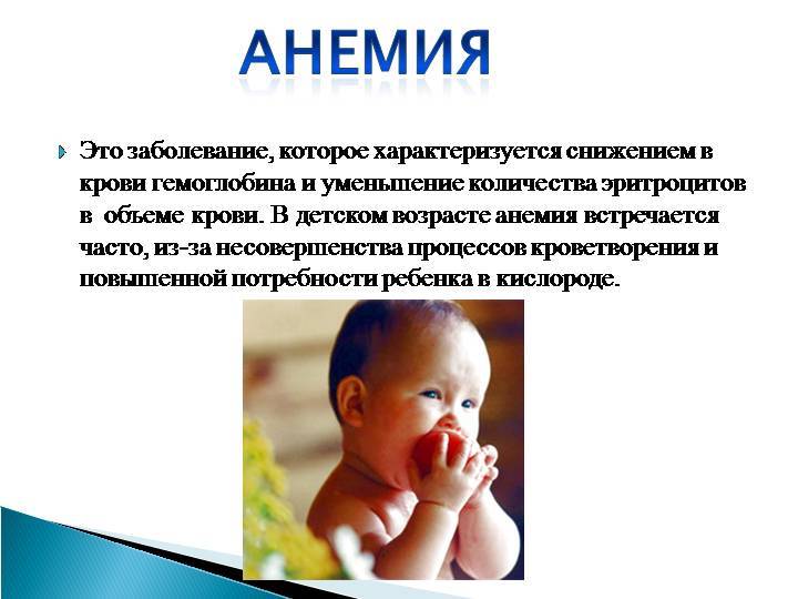 Анемия у детей: симптомы, причины развития и лечение анемии у детей - yod.ua