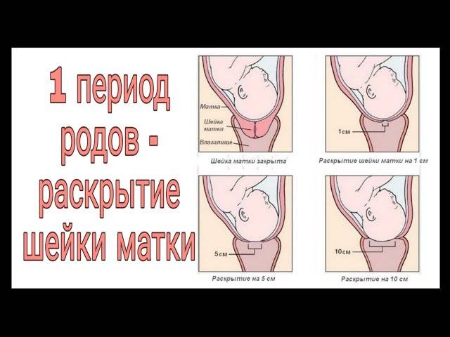 Гинекологическое выскабливание полости матки
