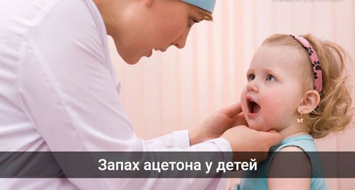 Доктор Комаровский о запахе ацетона изо рта у ребенка