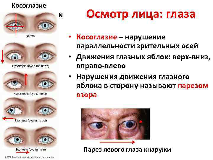 Психосоматика болезней глаз и зрения