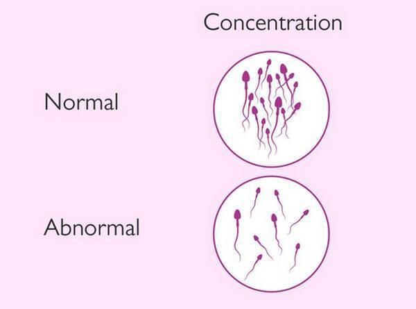 Что такое олигозооспермия и как она влияет на зачатие?