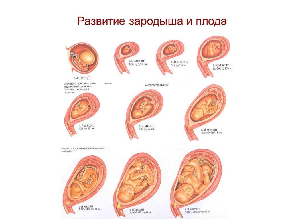 Многоплодная беременность, узи при многоплодной беременности