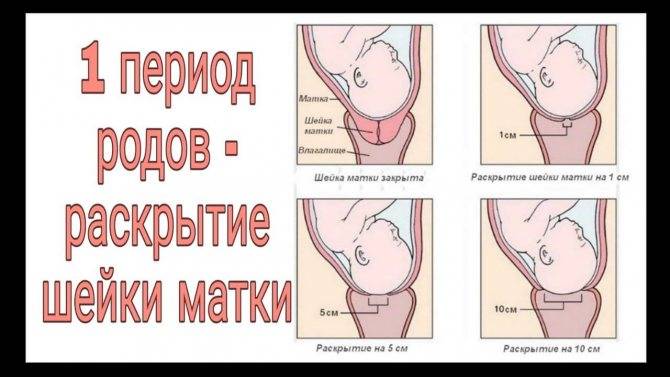 Кольпоскопия шейки матки: что это? рекомендации гинеколога