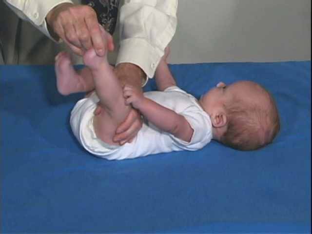 Тонус мышц ребенка и его нарушения