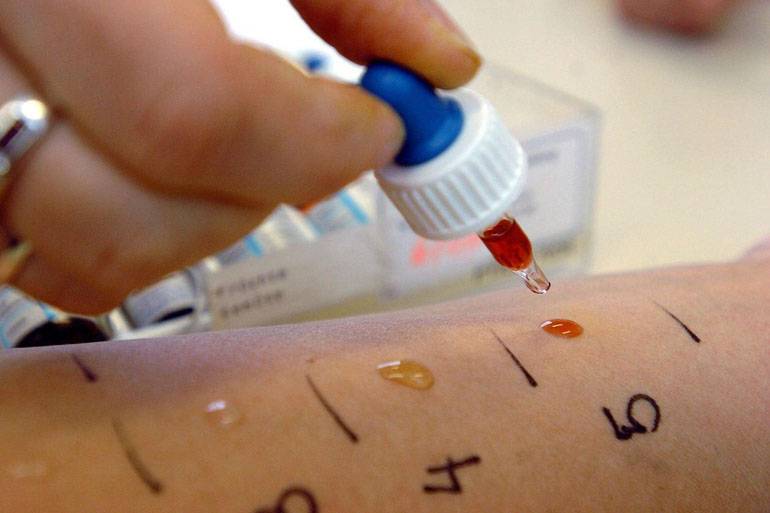 Кожные пробы на аллергены у детей: как делают и с какого возраста - kardiobit.ru