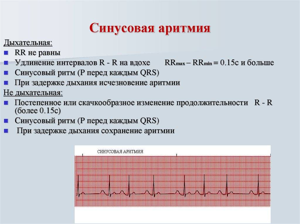 Аритмия дыхания | симптомы | диагностика | лечение - docdoc.ru