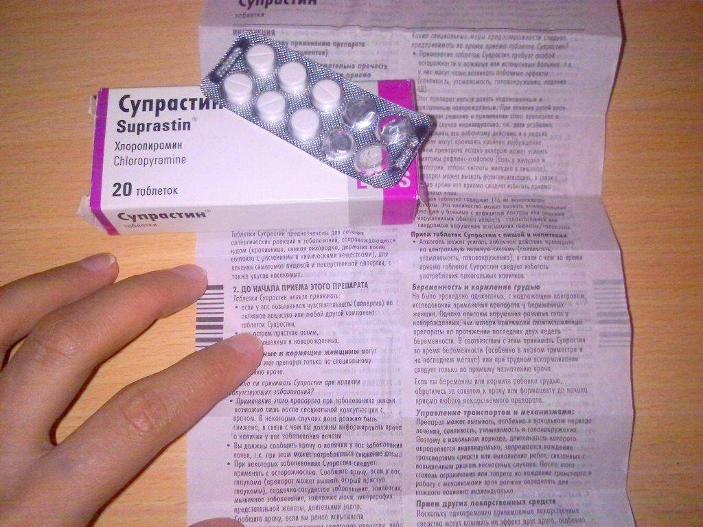 Супрастин − инструкция, применение детям, цена таблеток, отзывы