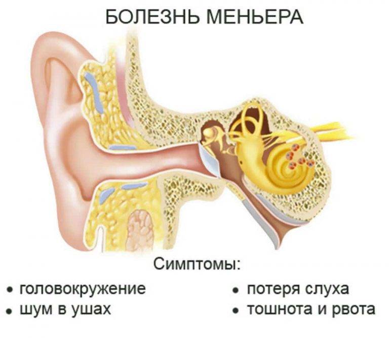 Шум в ухе, причины и лечение