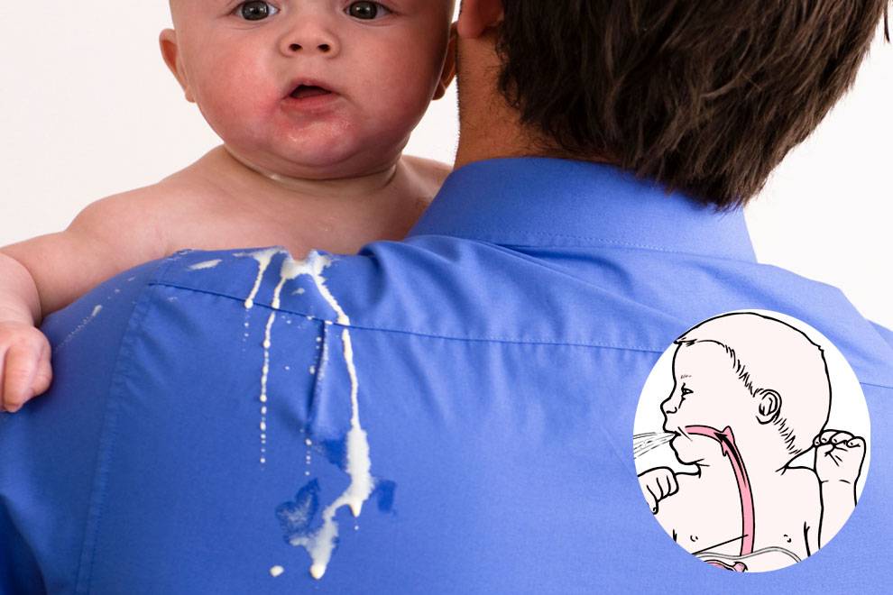 Почему ребенок постоянно срыгивает после кормления грудным молоком или смесью?