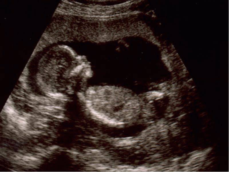 Как выглядит зародыш в 16 недель беременности фото