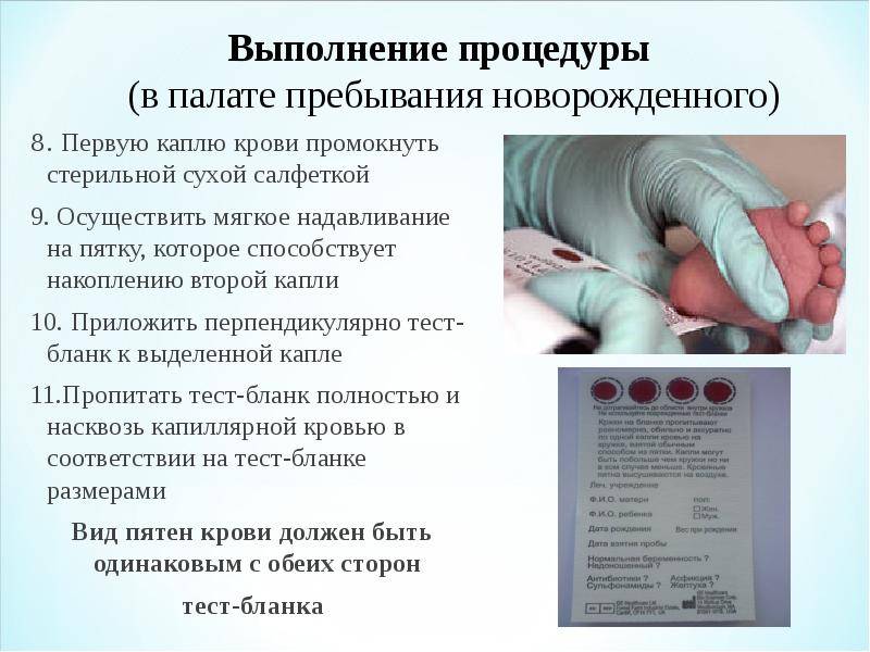 Приказ департамента здравоохранения г. москвы от 12 апреля 2011 г. n 315 “о массовом обследовании новорожденных детей на наследственные заболевания”
