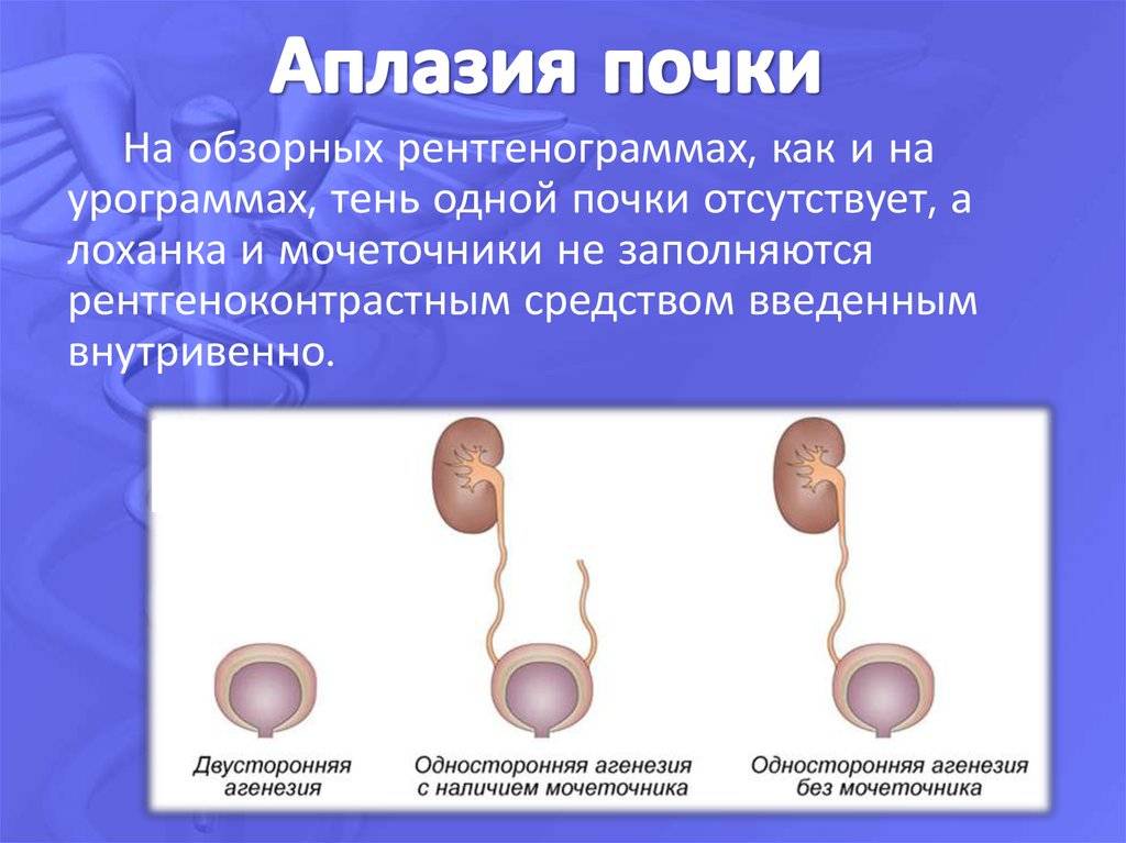 Врожденные пороки и аномалии развития | клиника "центр эко" в москве