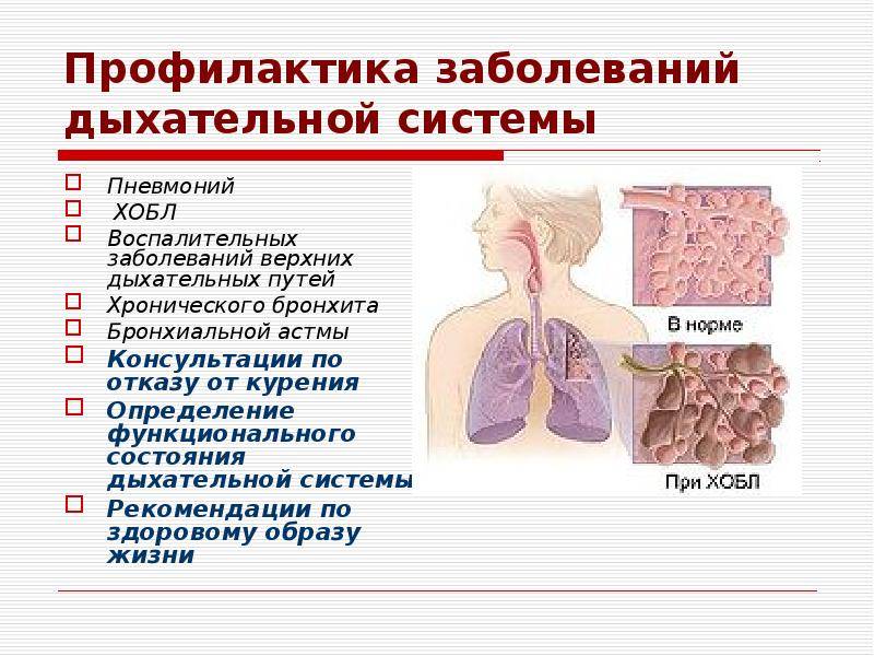 Детские болезни — заболевания нижних дыхательных путей