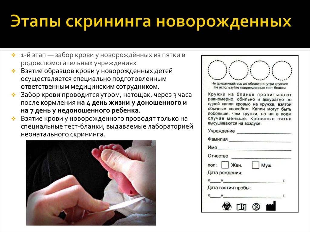 Неонатальный скрининг. зачем у младенца берут кровь из пяточки? - новорожденный. ребенок до года