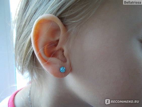 Не заживают уши после прокола у ребенка - сыктывкарская станция скорой медицинской помощи